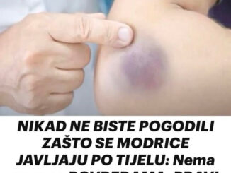 Modrice su čest fenomen